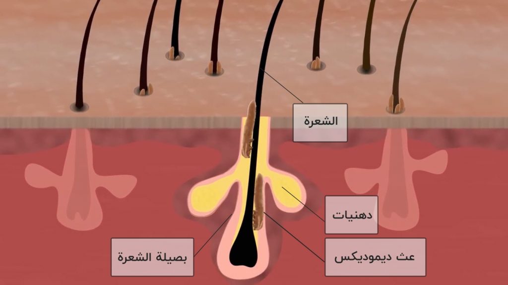 ديموديكس