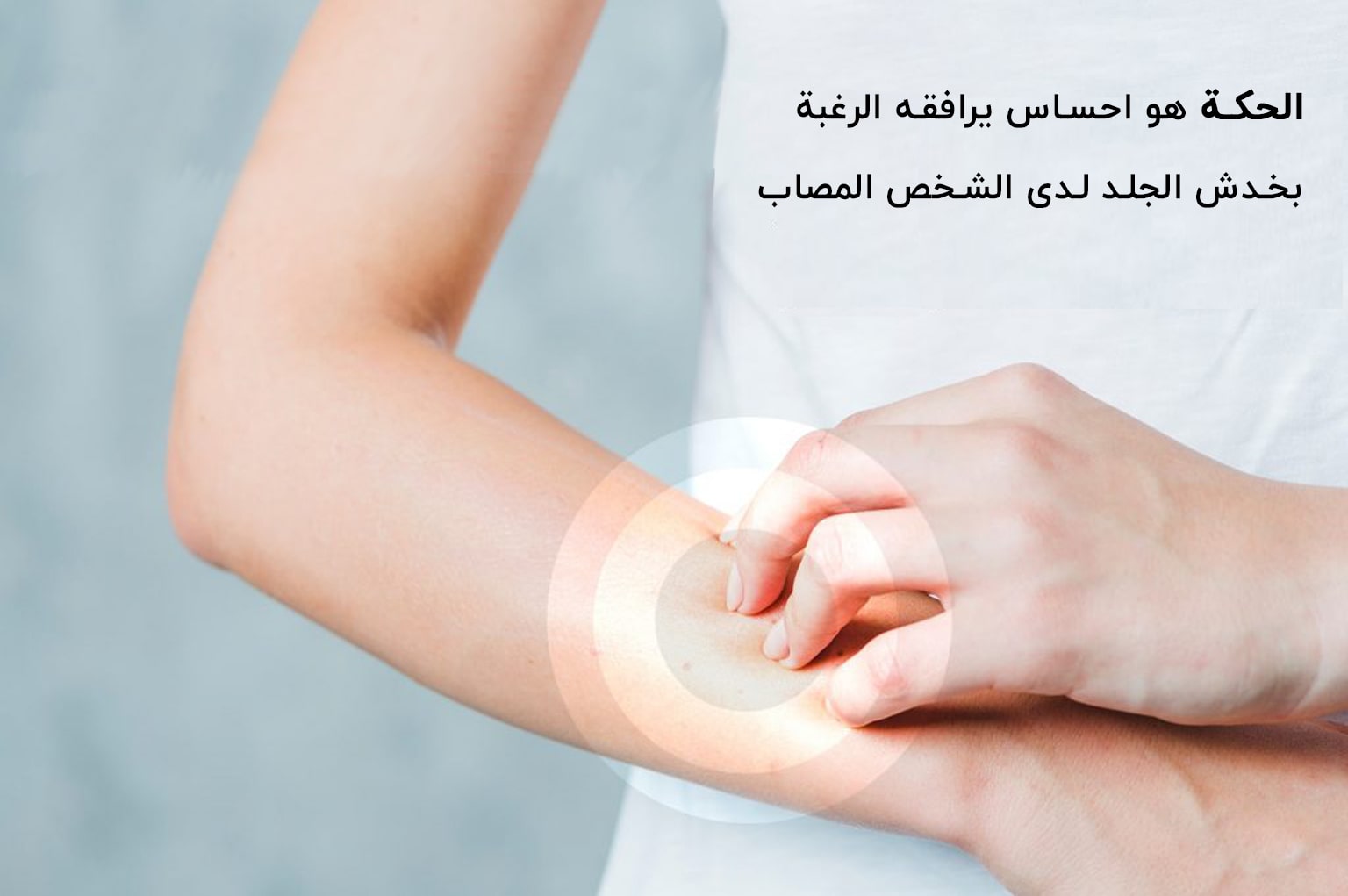 الحكة | انجکس