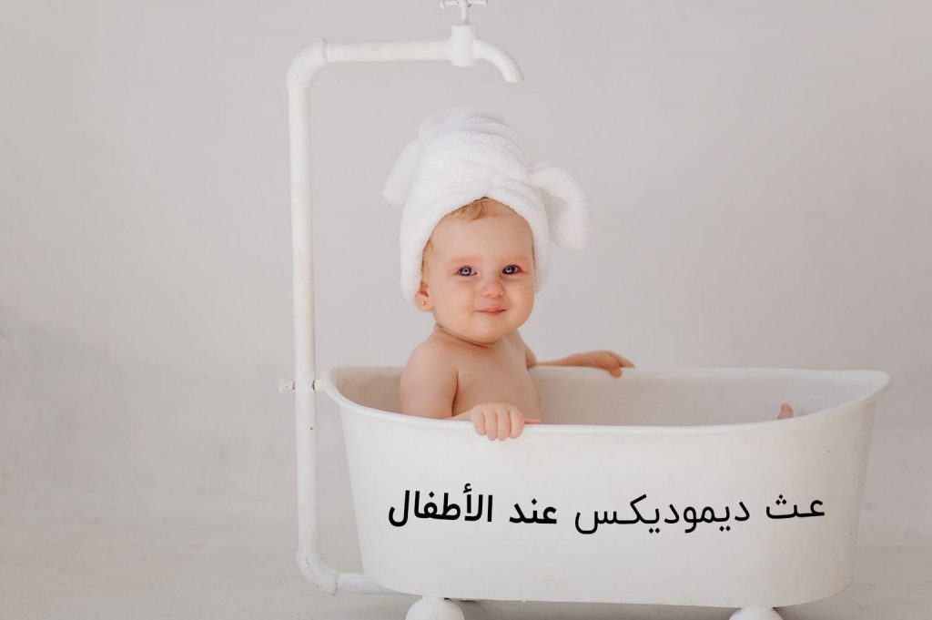 عث ديموديكس عند الأطفال | انجکس