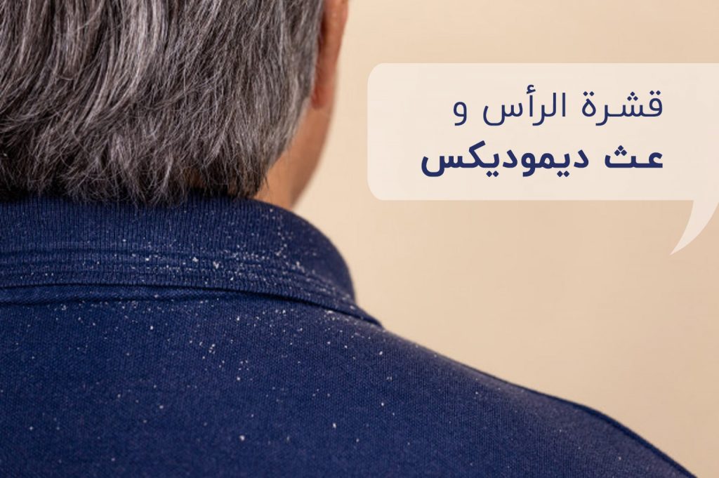 قشرة-الرأس-وعث-ديموديكس