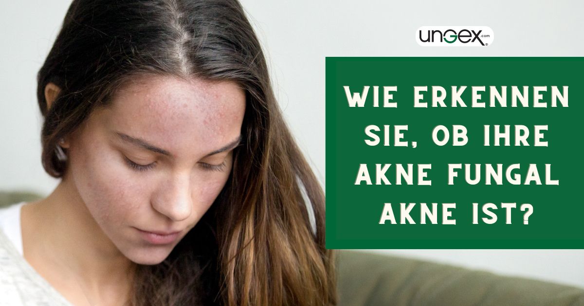 Was ist Fungal Akne