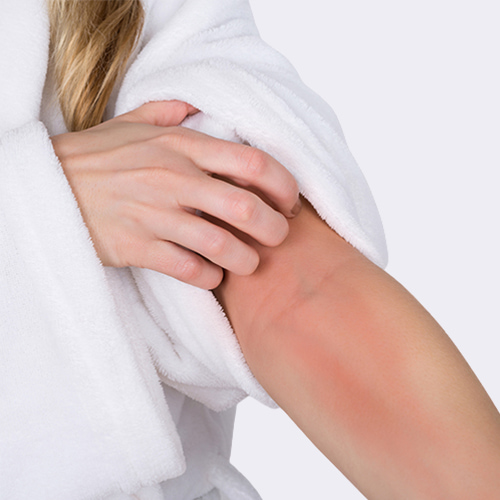 Itching-Demodex mites