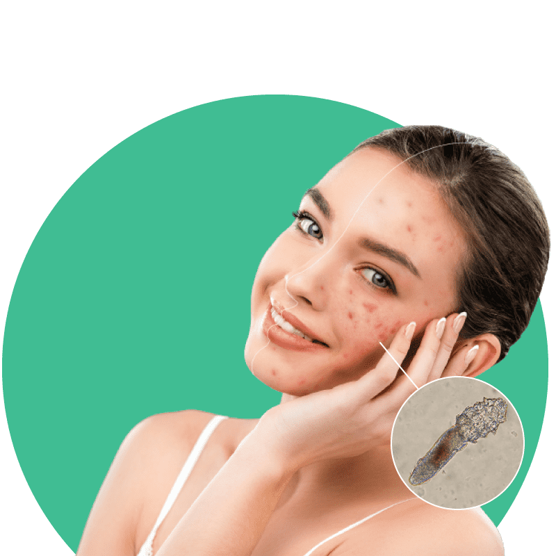 What are demodex mites