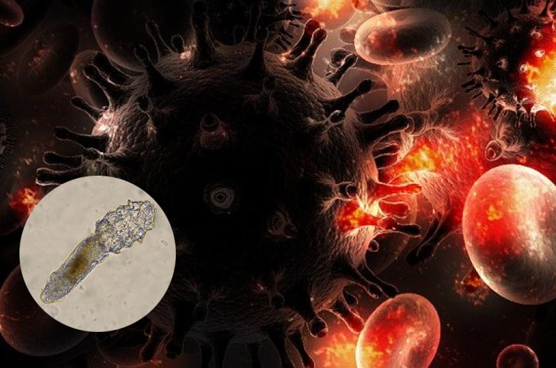 HIV AIDS Opportunities Infections Demodex mites