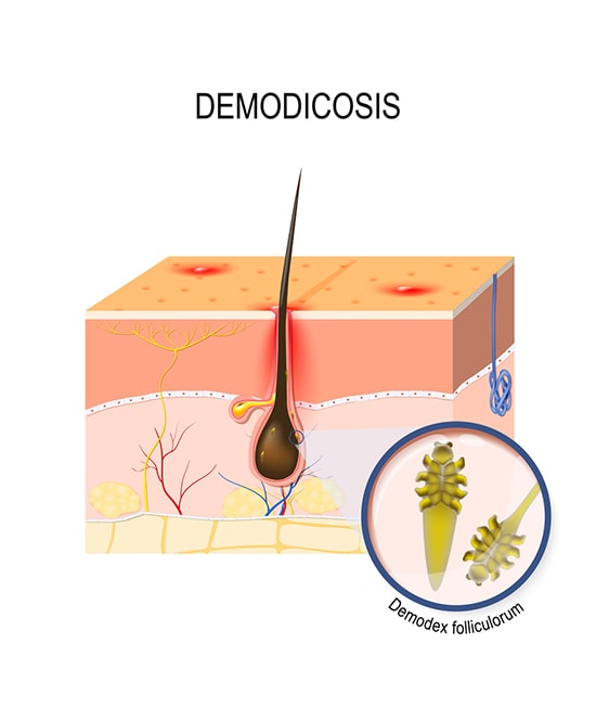 human hair hair follicle parasite