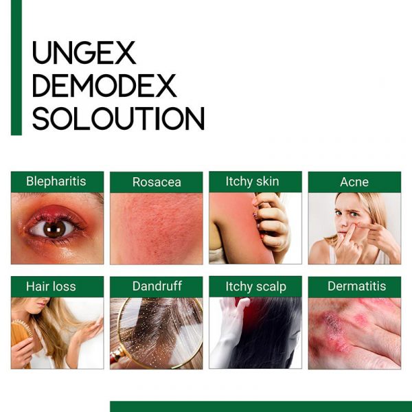 حل ungex-demodex
